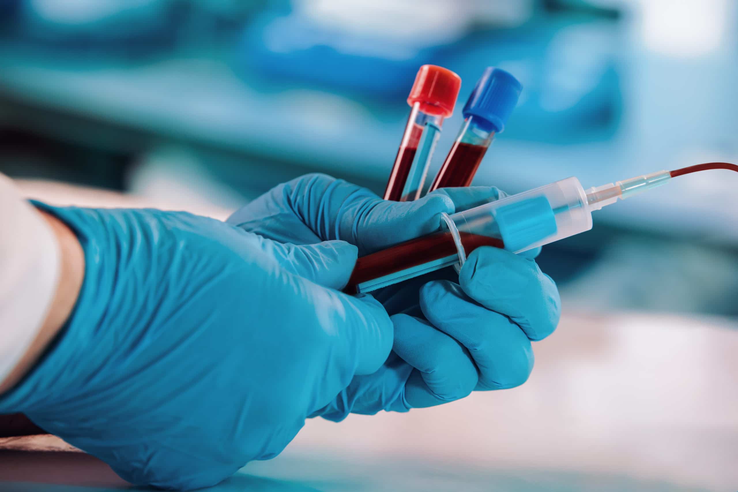 Simple Blood Test May Predict Long-Term Chronic Disease Risk